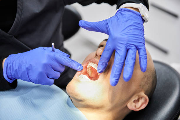 Best Emergency Dental Extractions in Wade, MS